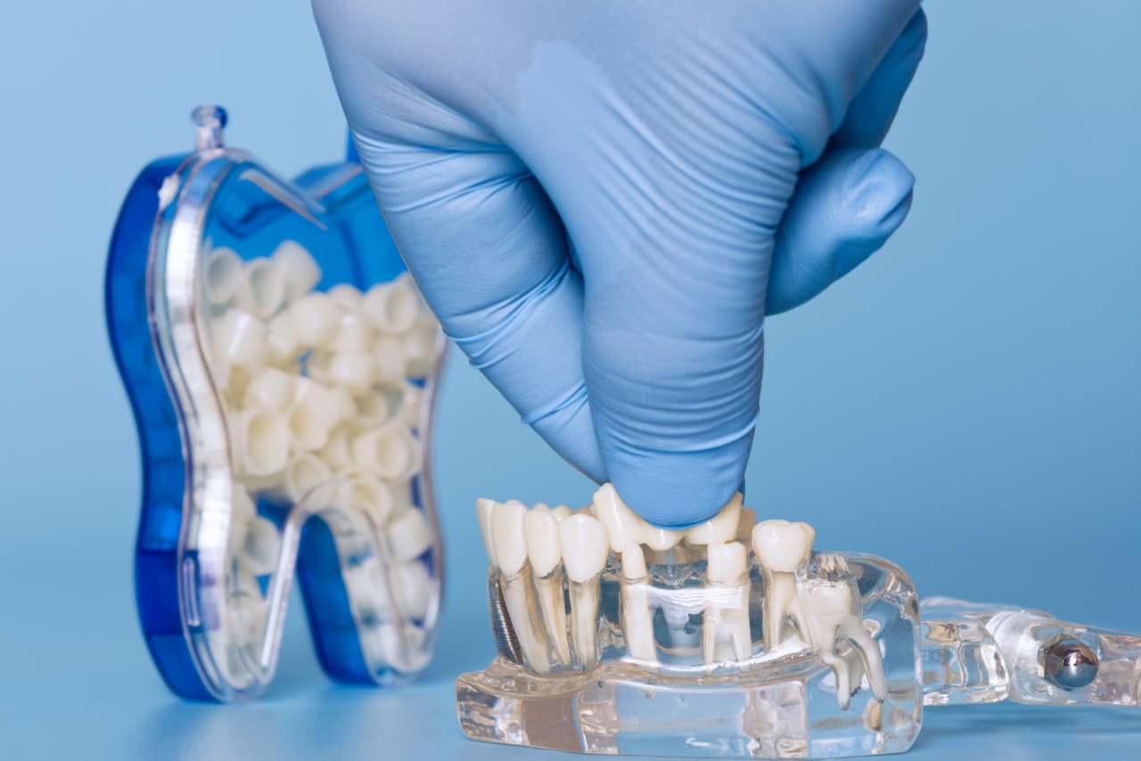 dental crowns https://azurmed.net/wp-content/uploads/2026/02/dental-crowns-1280x854.png